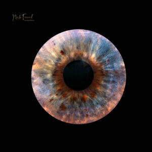 Optimierte Irisaufnahme in Fürth